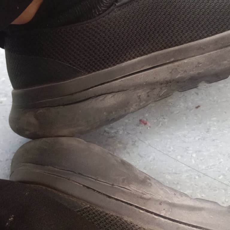 Skechers Arch Fit N-Joy Ayakkabısının Topuk Deformasyonu Ve Garanti Değişim Talebi