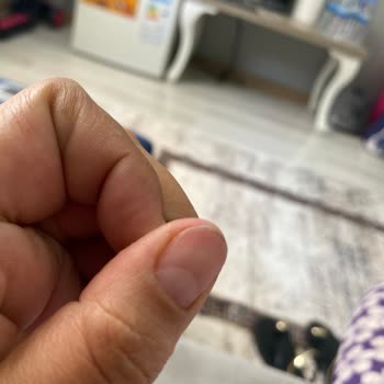 Si Beauty’de Hijyen Ve Yetkisiz İşlemler Nedeniyle Sağlık Sorunları Yaşadım
