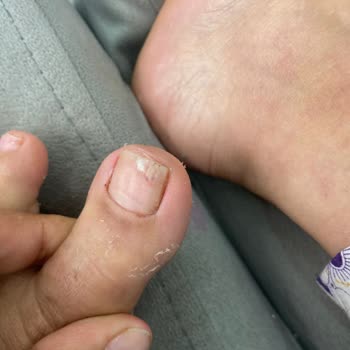 Si Beauty’de Hijyen Ve Yetkisiz İşlemler Nedeniyle Sağlık Sorunları Yaşadım