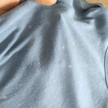 Vanish Oxi Action Kullanımına Rağmen Kıyafetlerde Beyaz Noktalar Ve Çamaşır Suyu İzleri