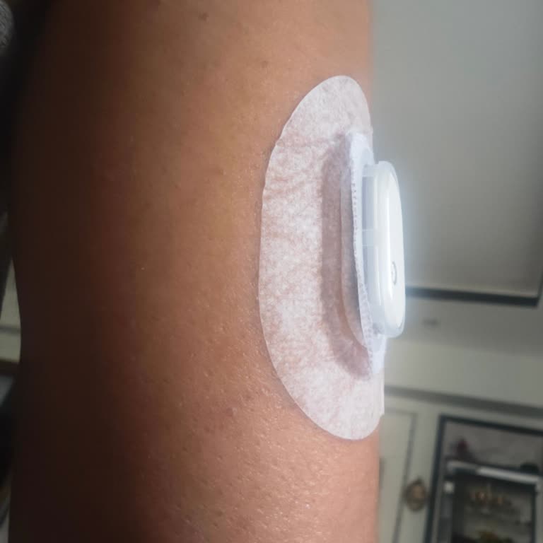 Sibionics GS1 Sensör Yapışma Sorunu, Ücretsiz Yenisi İsteniyor