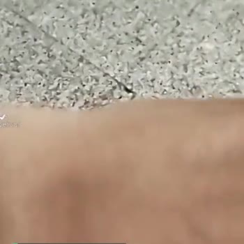 Antalya Eğitim Araştırma Hastanesi EKG Çalışma Saati Şikayeti