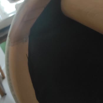 Bench Ani Kırılması Ve Servis İhmali
