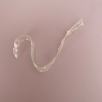 Patatesli Börekte Plastik Parça Çıktı, Çocuğum Neredeyse Yutacaktı