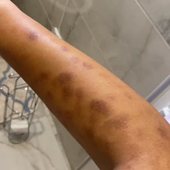 Cliniworld Estetik Yapılan İşlemin Arkasında Durmadı