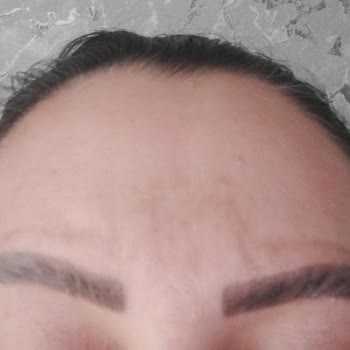 Kalitesiz Microblading Ve İade Talebi