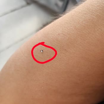Kolonyanın Püskürtme Başlığındaki Kaplama Soyulması Ciltte Parçacık Bırakıyor