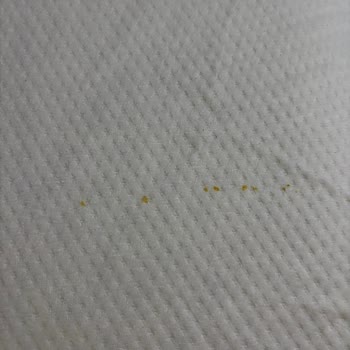 Arçelik Çamaşır Makinemde Sürekli Pas Lekesi Ve Yetersiz Servis Çözümü Talebi