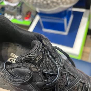 Skechers Ayakkabısı 10 Ayda Kullanılamaz Hale Geldi Ve İnceleme Sonrası Daha Da Bozuldu