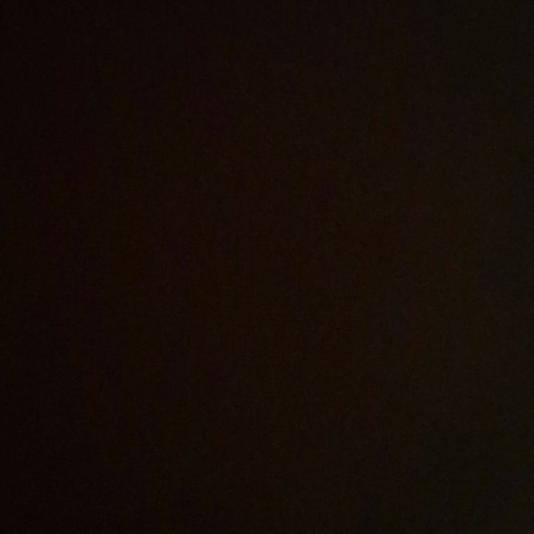 Zürih Sigorta Kasko Dosya Ödemesinde Aylardır Süren Gecikme Ve Cevapsızlık