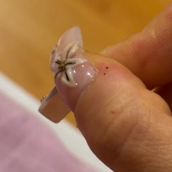 Çilek Nail House’da Protez Tırnak İşleminde Hava Alması Ve Şiddetli Ağrı, 1700 TL İade Talebi