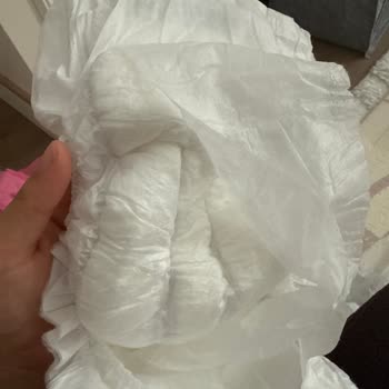 Molfix Bebek Bezlerinde İç Katman Açılması Sorunu Ve Ücret İadesi Talebi