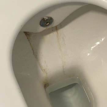 Hijyen Sorunu Nedeniyle Konaklamama Ve Açıklanmayan İade Kesintisi
