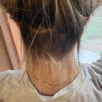 Hair Stars Coiffuer Saç Yanması Ve Fiyat Şantajı Kuaförde Yaşanan Ciddi Mağduriyet