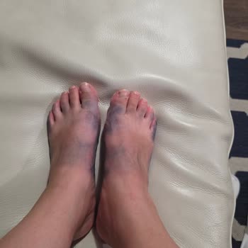 Ayak Boyasının Masmavi Renk Değişimi Ve İade Talebi