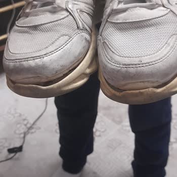 Garanti Kapsamında Ayakkabının Açılması Reddi Ve Değişim Talebi