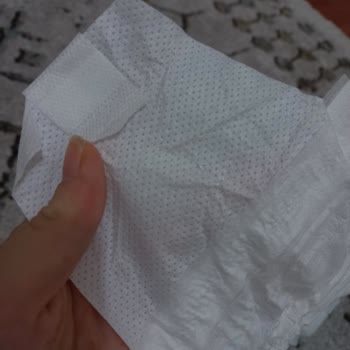 Molfix Bebek Bezlerinde Kalitesiz Üretim Sorunu Ve Şiddetli Cilt Tahrişi