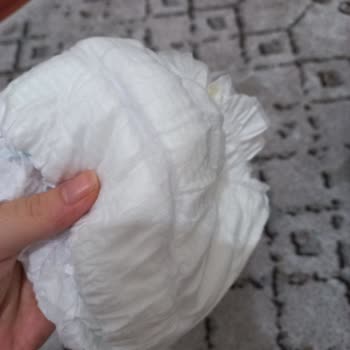 Molfix Bebek Bezlerinde Kalitesiz Üretim Sorunu Ve Şiddetli Cilt Tahrişi