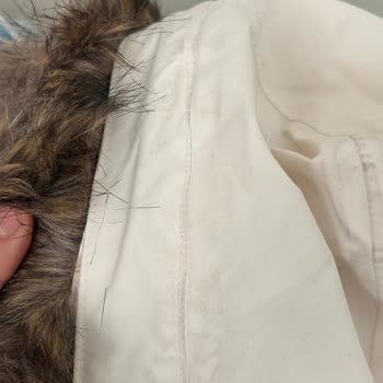 Kirli The North Face Parka Teslimatı Ve İade Talebi