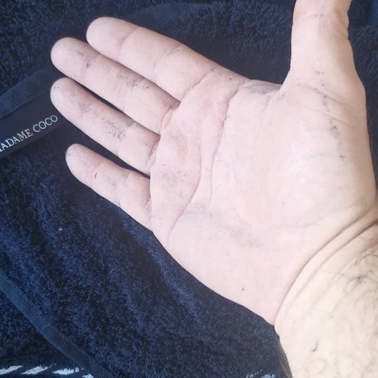 Madame Coco Bornozda Aşırı Tüy Bırakması Ve İade Talebi