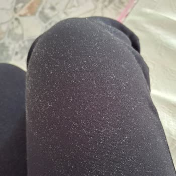 Arçelik Çamaşır Makinesinde Toz Ve Tüy Çıkarma Sorunu, Servisin İlgisiz Tutumu Ve Para İadesi Talebi