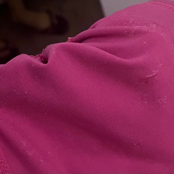 Göğüs Pedinde Cilt Tahrişi Ve Morarma, Şirketten Yanıt Ve İade Talebi