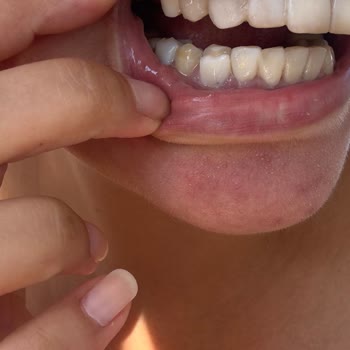 Dr. Taha Clinic ciddi ağrı ve rahatsızlık hissediyorum