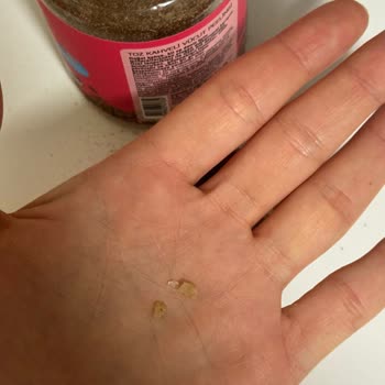 Sert Parçalar İçeren Peeling Ürünü Ciltte Şiddetli Tahriş Yarattı