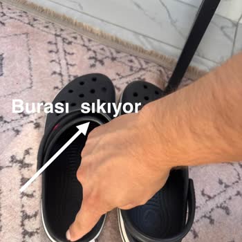Ayıplı Crocs Terliği, Müşteri Hizmetlerinden Çözüm Gelmiyor