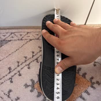 Ayıplı Crocs Terliği, Müşteri Hizmetlerinden Çözüm Gelmiyor