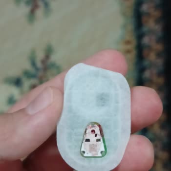 24 Saat Bekleme Şartı Nedeniyle Ağrılı Sensör Çıkarma Ve Acil Yenisi Talebi