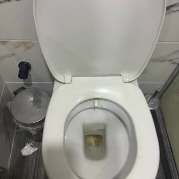 Balayımızda Hijyen Eksikliği Ve İlgisizlik Kabusa Dönüştü
