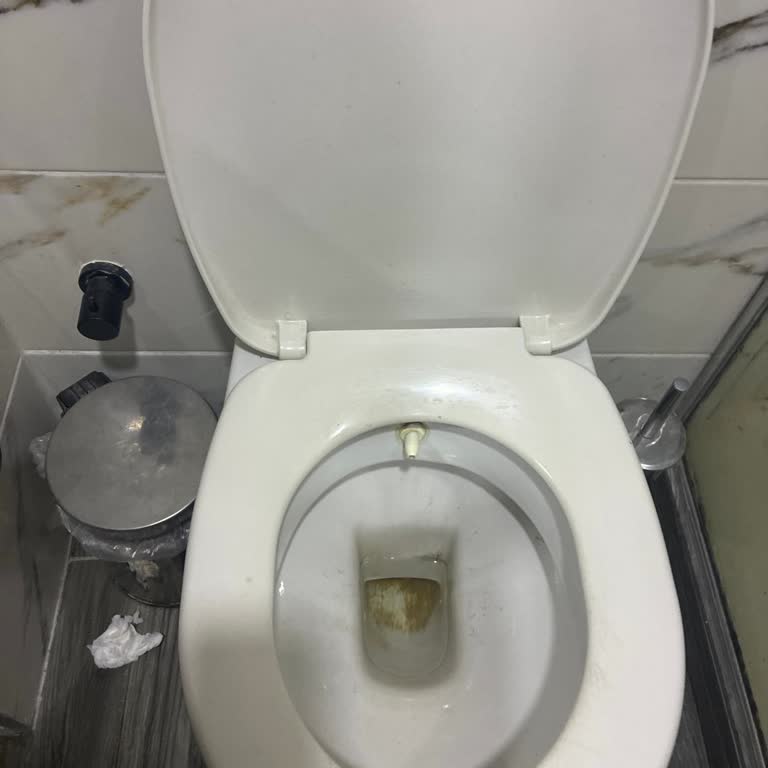 Balayımızda Hijyen Eksikliği Ve İlgisizlik Kabusa Dönüştü