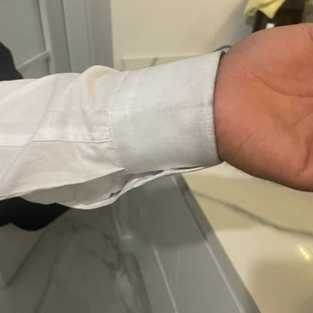 Takım Elbiseden Kaynaklı Siyah Lekeler Gömleği Kullanılamaz Hale Getirdi
