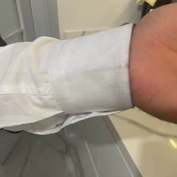 Takım Elbiseden Kaynaklı Siyah Lekeler Gömleği Kullanılamaz Hale Getirdi