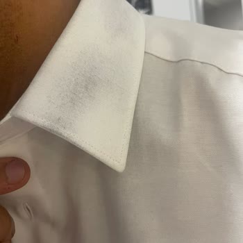 Takım Elbiseden Kaynaklı Siyah Lekeler Gömleği Kullanılamaz Hale Getirdi