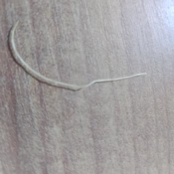 Ruffles Cipsinde Bulunan Yabancı Nesne Gıda Güvenliği Sorunu