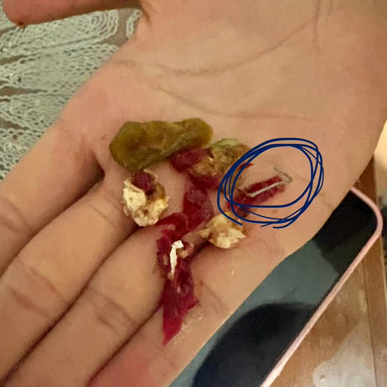 Zımba Telinin Çiğköfte Dürüme Karışması Ve Saygısız Müşteri Yanıtı