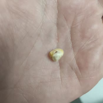 BİM Banabi Kekinde Yabancı Madde Bulunması Ve Geri Çağrı Talebi