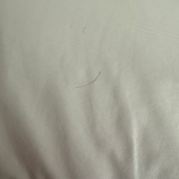 Asteria Collection Side Otelinde Kabul Edilemez Hijyen Sorunları Ve ETS Tur'un Çözüm Sağlamaması