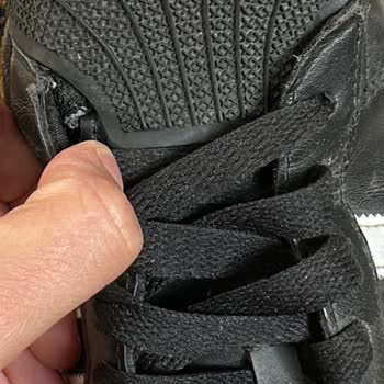 Ankara Antares Etichet Mağazasında Adidas Superstar Ayakkabılarda Erken Yıpranma Ve Değişim Reddi