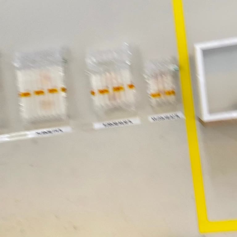 DHL Şubesinde Poşet Zorlaması Ve Kutu Gerekliliği