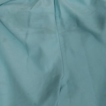Adidas Mayosunda İlk Kullanımda Lekelenme, Mağazanın İnceleme Talebini Reddetmesi