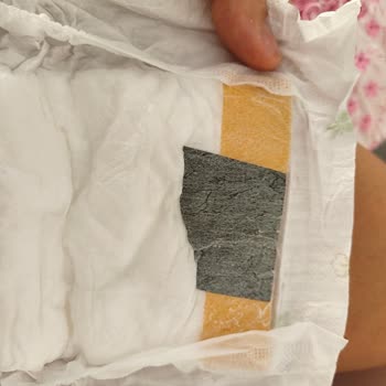 Bebek Bezinde Sert Yabancı Madde Ve Çocuk Güvenliği Endişesi