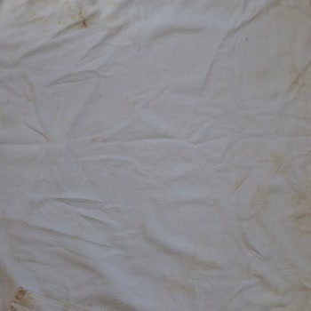 Havlu Ücretinden 870 TL Haksız Talep Ve Kirli Su Kaynağından Hastalık