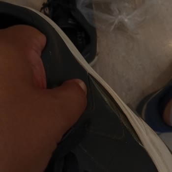 Skechers Ayakkabısında Erken Yırtılma Ve Garanti Reddi Talebi