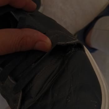 Skechers Ayakkabısında Erken Yırtılma Ve Garanti Reddi Talebi
