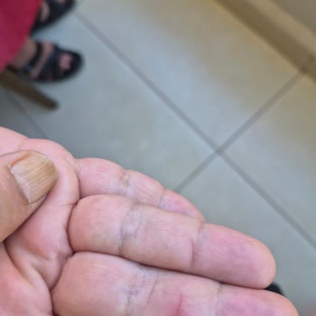 Duru Katı El Sabunu İçinde Cam Parçası Çıktı Kullanıcılar Tehlikede