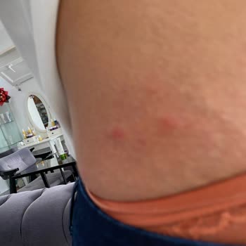 Böceklerle Dolu Otobüste Hijyen Ve Sağlık Sorunu