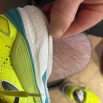 Joma Ayakkabısının Kısa Sürede Taban Açılması Ve Firmadan Reddetme
